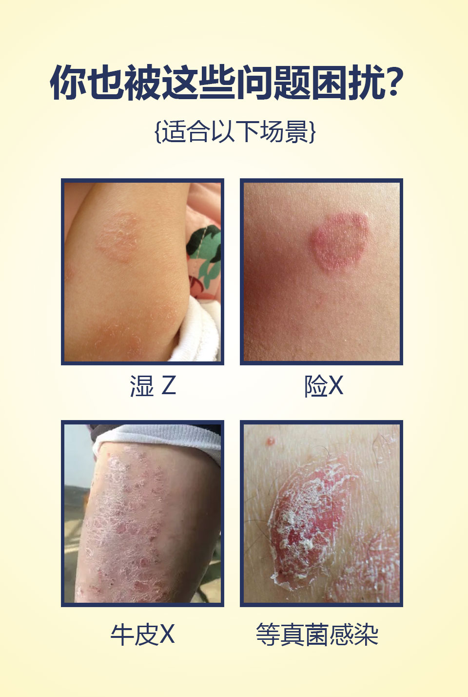 抗靈膚寧劑詳情頁癥狀1.jpg